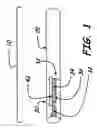 Fig. 02 - SMOKING ARTICLE AND SMOKING ARTICLE FILTER