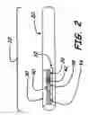 Fig. 03 - SMOKING ARTICLE AND SMOKING ARTICLE FILTER