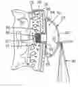 Fig. 01 - HAIR EXTENSION DEVICES AND METHODS