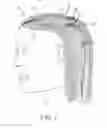 Fig. 02 - HAIR EXTENSION DEVICES AND METHODS