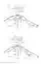 Fig. 09 - Umbrella apparatus