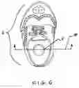 Fig. 07 - Crutch foot