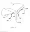 Fig. 16 - Auxiliary section for a canopy