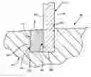 Fig. 01 - Method of forming a cast metal article