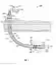 Fig. 02 - Apparatus and method for estimating orientation of a liner during drilling of a wellbore