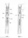 Fig. 23 - Downhole Tool