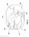 Fig. 10 - Radiation shielding device