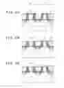Fig. 09 - Semiconductor device with forwardly tapered P-type FET gate electrode and reversely tapered N-type FET gate electrode and method of manufacturing same