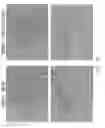 Fig. 11 - AGENTS FOR SUPPRESSING HEPATIC FIBROSIS