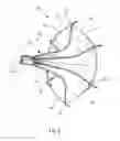 Fig. 03 - Apparatus and method for making a spider occlusion device