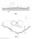 Fig. 03 - Composite material human body support and process for making same
