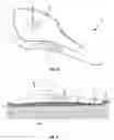 Fig. 04 - Composite material human body support and process for making same
