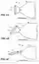 Fig. 07 - Ribbon crystal string for increasing wafer yield