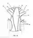 Fig. 06 - Posture improvement devices and methods for use