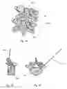 Fig. 02 - Device and method for placement of interbody device
