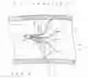 Fig. 01 - SPIDER DEVICE WITH OCCLUSIVE BARRIER