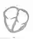Fig. 02 - Spider PFO closure device