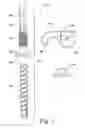 Fig. 02 - Method and system for securing a rod to a bone anchor with a connector