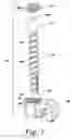 Fig. 02 - Connector for securing an offset spinal fixation element