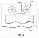Fig. 08 - Screw back-out prevention mechanism