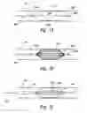 Fig. 06 - Methods and systems for thermally-induced renal neuromodulation
