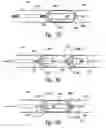 Fig. 08 - Methods and systems for thermally-induced renal neuromodulation