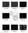 Fig. 02 - Quantum dot labeled stem cells for use in providing pacemaker function