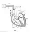 Fig. 02 - Self-referencing communication in implantable devices