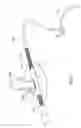 Fig. 07 - Pancreas lead