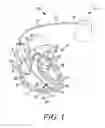 Fig. 02 - Medical device electrodes including nanostructures