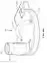 Fig. 08 - Bagless dustcup