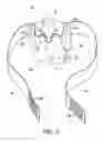 Fig. 04 - Nose mask assembly to be worn during sleep having a suspension support bracket and a retractable line