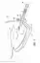 Fig. 09 - Nose mask assembly to be worn during sleep having a suspension support bracket and a retractable line