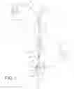 Fig. 02 - Hanging apparatus assembly and method