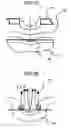 Fig. 08 - Scanning electron microscope
