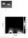 Fig. 07 - Probe, system and method suitable for unilateral nuclear magnetic resonance