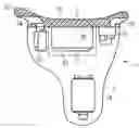 Fig. 01 - Hearing device with a contact unit and an associated external unit
