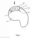 Fig. 08 - Protective Finishing Plug For A Hearing Instrument Shell
