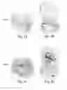 Fig. 02 - Methods and reagents for the enhancement of virus transduction in the bladder epithelium