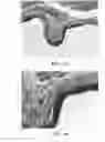 Fig. 08 - Methods and reagents for the enhancement of virus transduction in the bladder epithelium