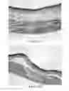 Fig. 22 - Methods and reagents for the enhancement of virus transduction in the bladder epithelium