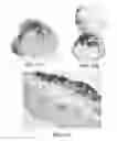 Fig. 43 - Methods and reagents for the enhancement of virus transduction in the bladder epithelium