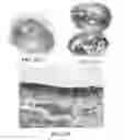 Fig. 45 - Methods and reagents for the enhancement of virus transduction in the bladder epithelium
