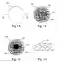 Fig. 02 - EMBOLIZATION PARTICLES