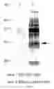 Fig. 23 - Method of producing sugar chain using human G4 polypeptide