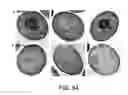 Fig. 82 - and HAC1 nucleic acids
