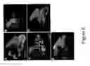 Fig. 07 - Gene therapy for spinal cord disorders