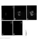 Fig. 08 - Gene therapy for spinal cord disorders