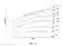 Fig. 07 - SIMPLIFIED CONTROLS FOR IMPLEMENTING DEPTH-BASED GAIN CONTROL IN ULTRASOUND SYSTEMS