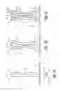 Fig. 02 - Retrospective dynamic transmit focusing for spatial compounding
